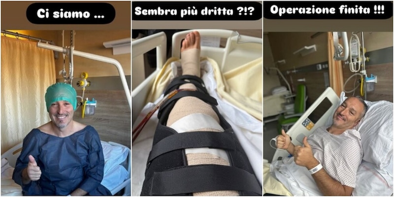 Zambrotta si è operato al ginocchio e condivide la gamba sui social con un sorriso