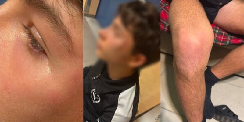 Arresto di un giovane arbitro in Puglia: l'AIA denuncia violenza e richiede rispetto