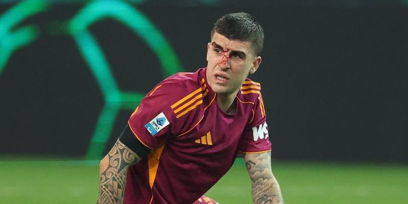 Mancini: frattura al naso curata con intervento chirurgico, indosserà maschera protettiva